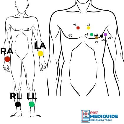 ECG electrode placement positions