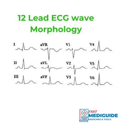 12 lead ecg showing morphology of waves on each lead